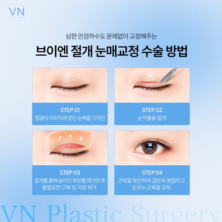 Eyelid Correction? The Difference Between Incisional and Non-Incisional Methods! image 3