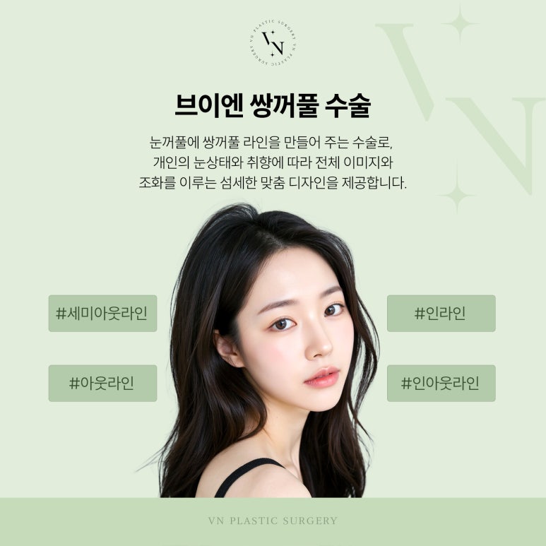 브이엔성형외과, 쌍꺼풀 수술과 눈매교정 차이점은? 관련 이미지 2