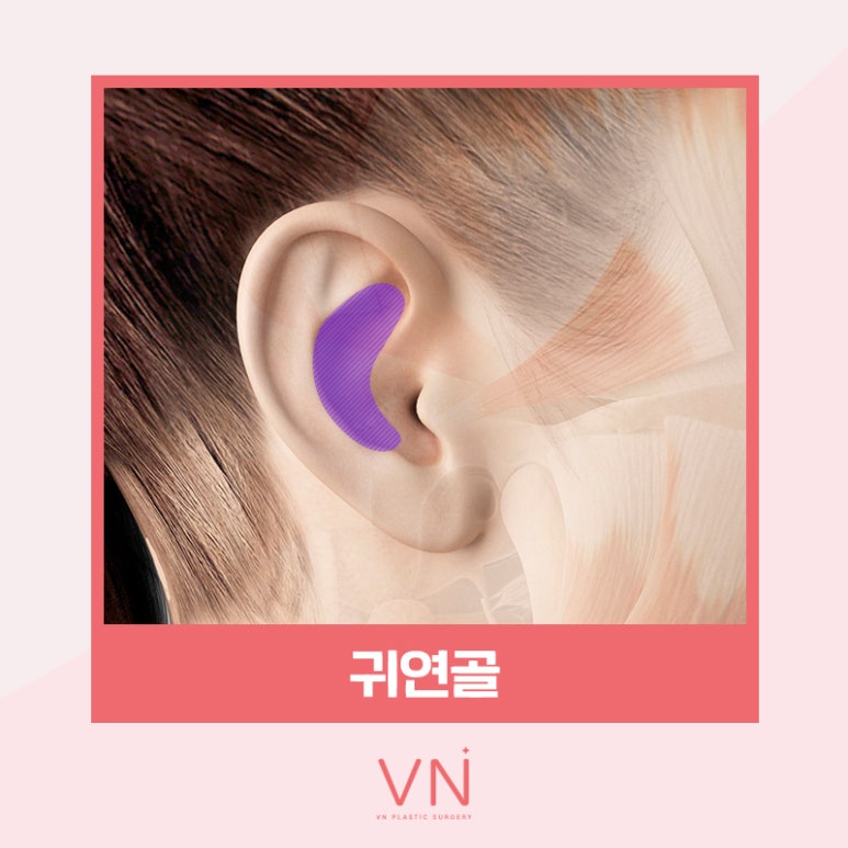 코성형수술 전이라면 클릭🖱 (feat. 수술재료 모아보기) 관련 이미지 4