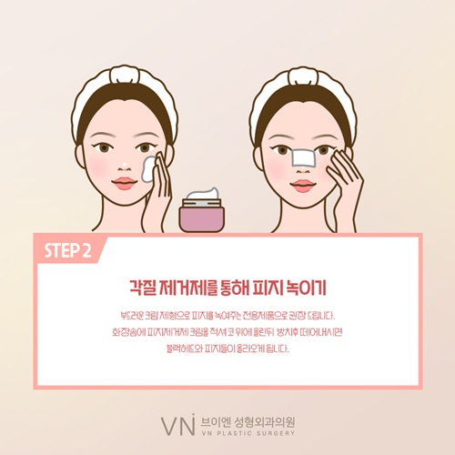 Nose Surgery Pore Care Tips from VN Plastic Surgery! image 2
