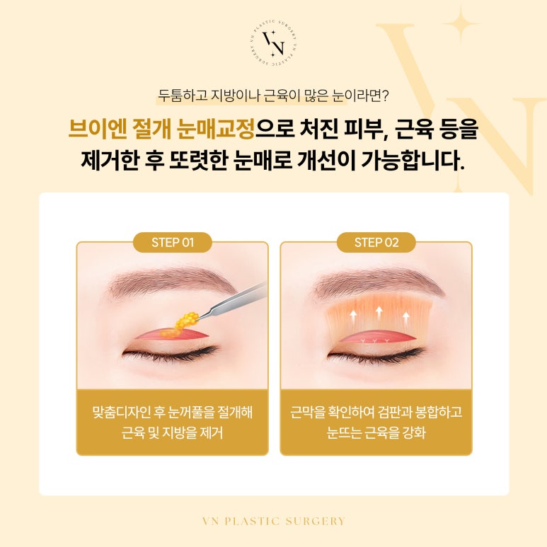 졸려 보이는 눈, 어떻게 해야 하나요? 관련 이미지 3