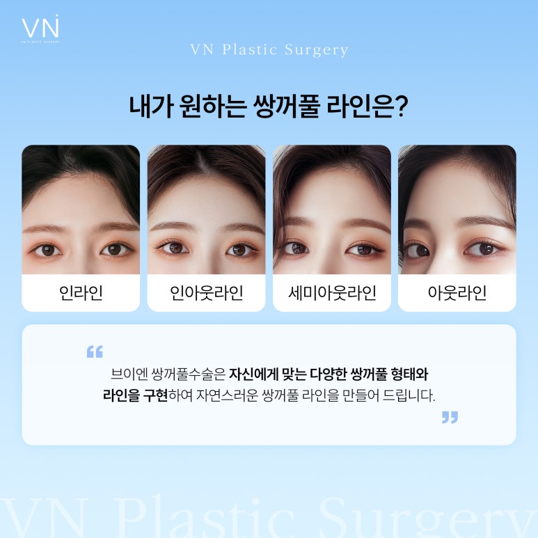쌍꺼풀 라인, 어떤 차이점이 있을까?(ft. 인라인,인아웃,세미아웃,아웃) 관련 이미지 2