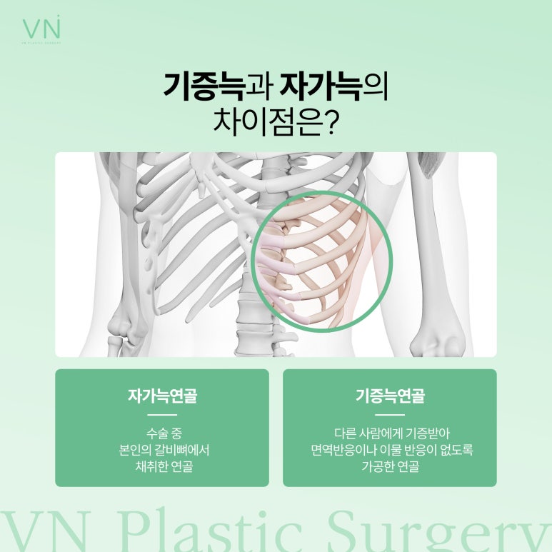 코수술시 사용되는 재료, 자가늑 기증늑의 차이점 관련 이미지 2