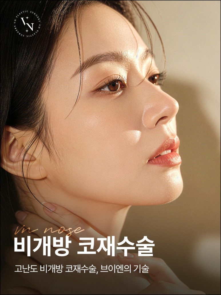 VN Plastic Surgery: When Closed Revision Rhinoplasty Is Possible (Side Effects / Contour / Nasal Tip) image 1