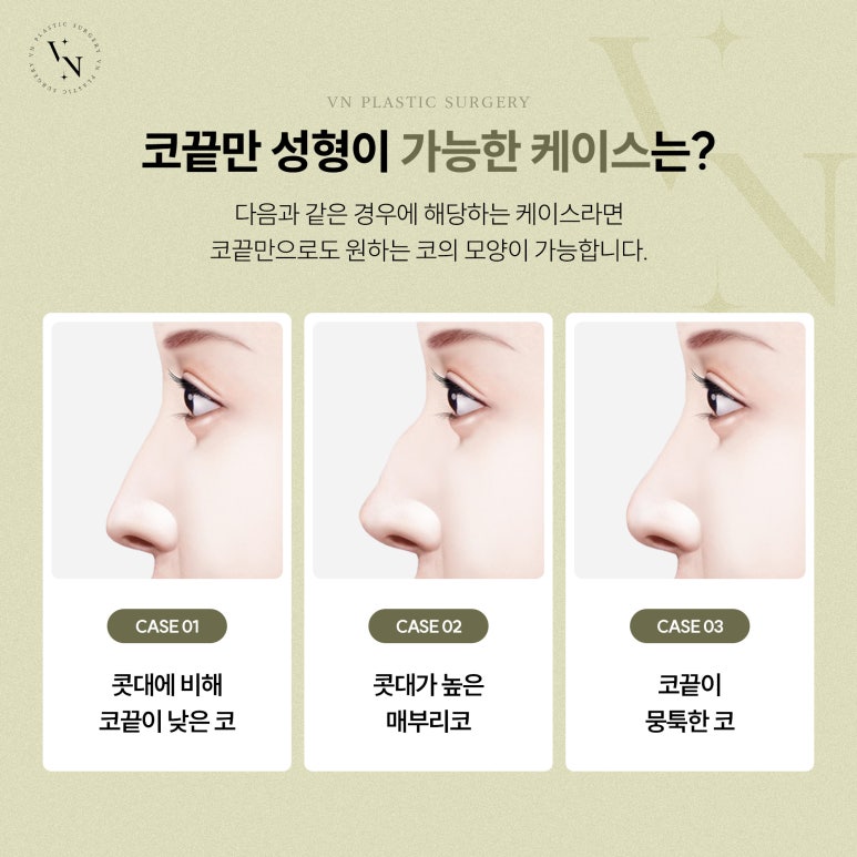 코끝만 성형할 수 있을까? 관련 이미지 4