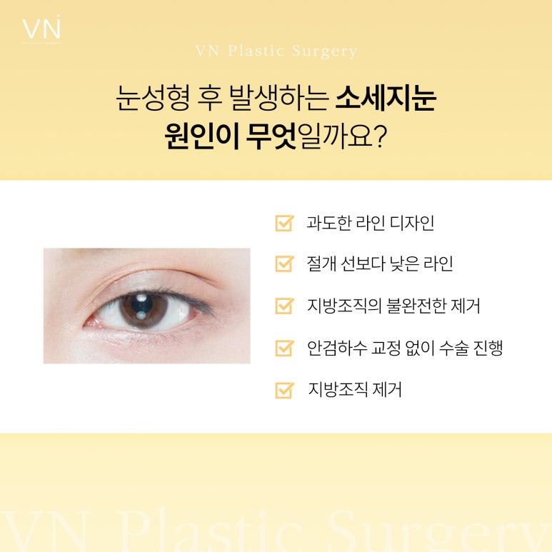 눈성형 실패 후 소세지 눈, 두꺼운 쌍꺼풀로 스트레스 받는다면? 관련 이미지 3