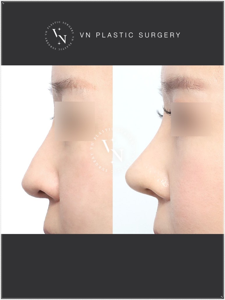 Turn Your Complexes into Confidence: How to Apply for the VN Plastic Surgery Real Model Program image 6