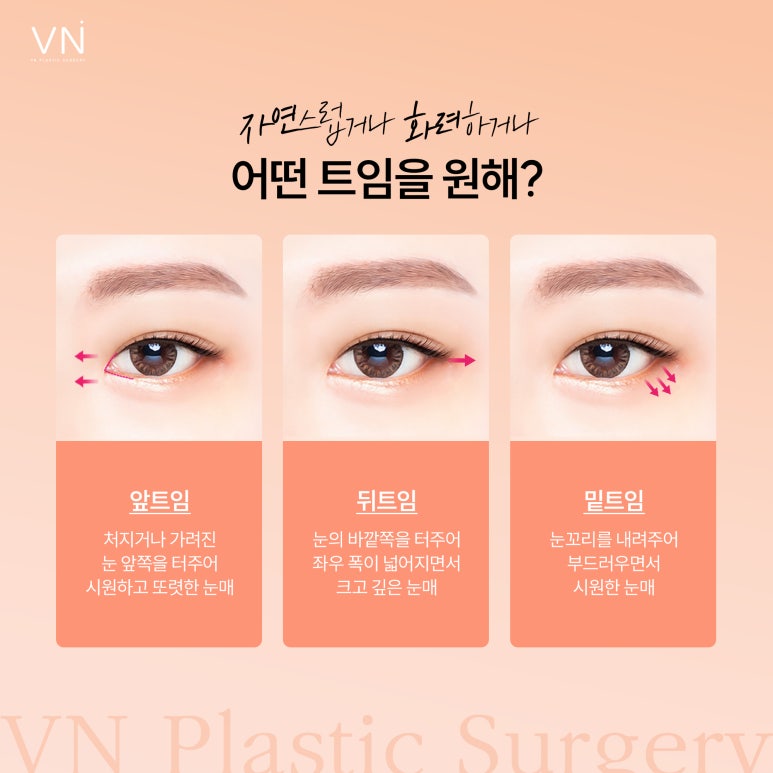 답답해 보이는 눈, 트임 성형으로 개선할 수 있을까? 관련 이미지 2