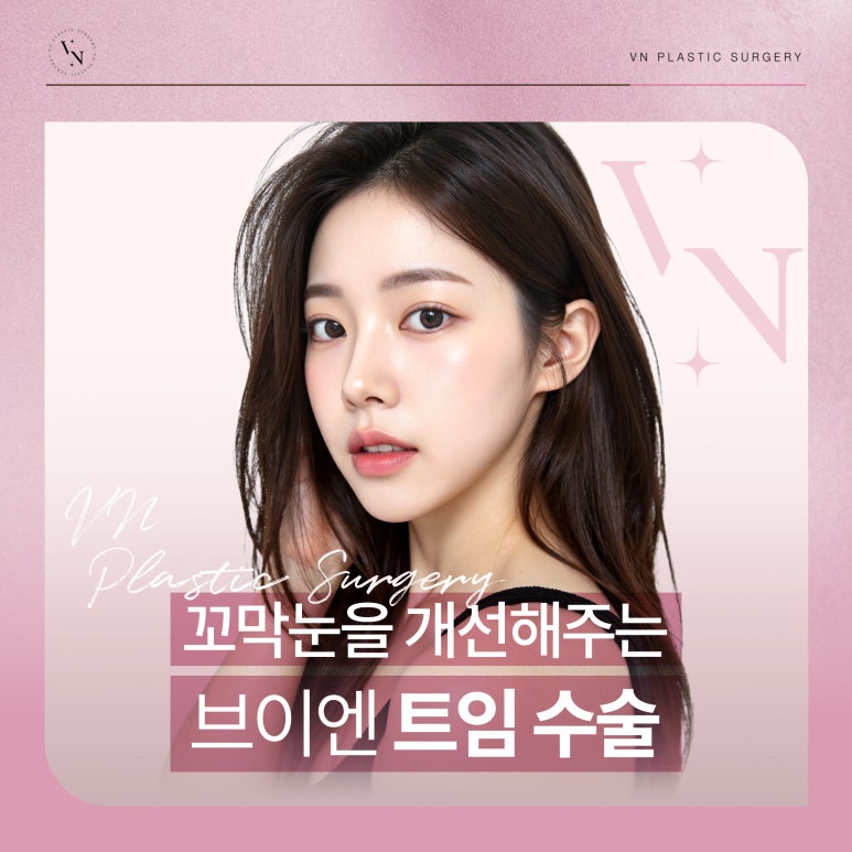 브이엔성형외과, 꼬막눈 개선하는 트임수술 관련 이미지 1