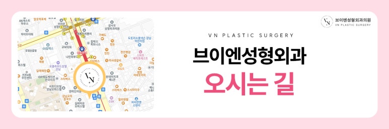 앞트임 없이도 또렷해 보이는 눈매를 원한다면? 관련 이미지 8