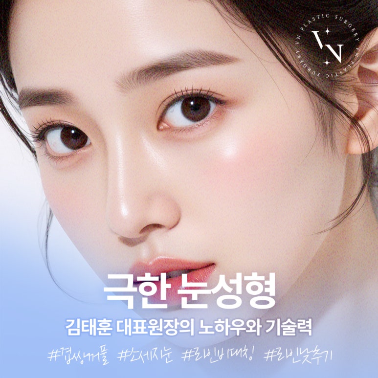 [강남/신논현 브이엔성형외과] 극한눈성형, 다시 찾는 자연스러운 눈매 관련 이미지 1