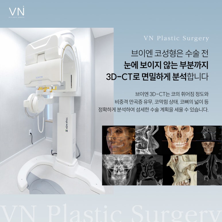 나에게 어울리는 코라인은? #직반라인 #직선라인 #반버선라인 관련 이미지 6