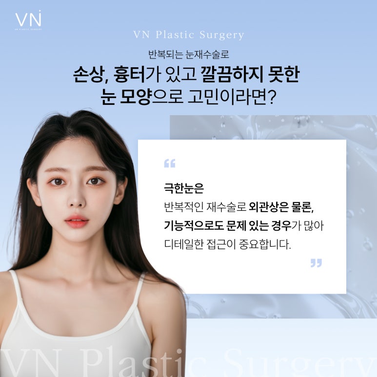 눈 성형의 끝판왕, 극한눈성형 관련 이미지 2