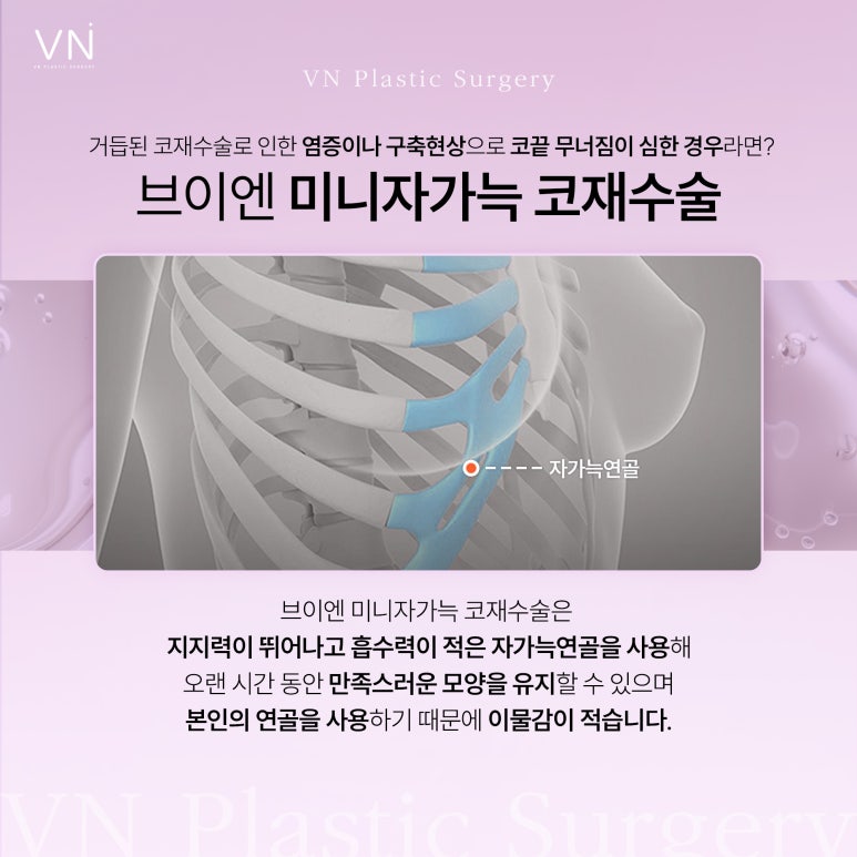 실패없는 미니자가늑 코재수술? 관련 이미지 2