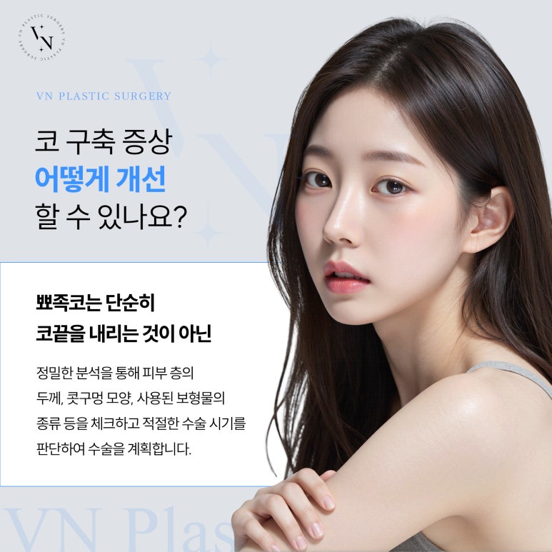 뾰족코 개선을 위한 코재수술 관련 이미지 4