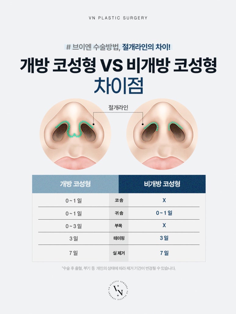 무보형물코성형으로 완성하는 자연스러운 변화, 강남역 성형외과 선택 노하우 관련 이미지 5
