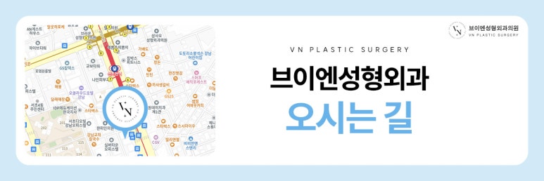 [VN Plastic Surgery] Closed Rhinoplasty Revision: Can It Reduce Scar Concerns and Be Tried Again? image 9