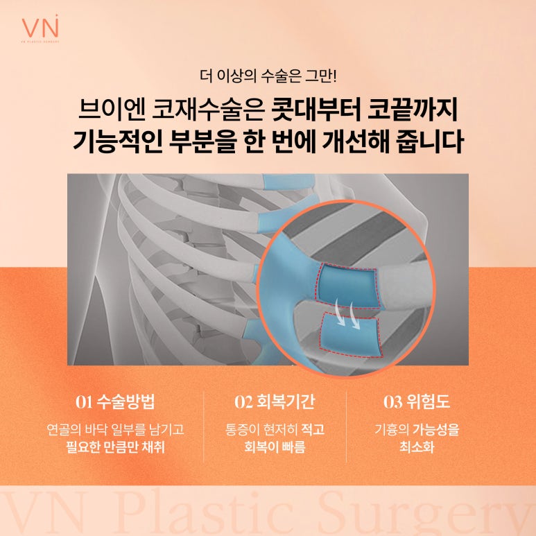 코재수술 시 어떤 재료로 수술해야 할까요? (ft. 미니자가늑코재수술) 관련 이미지 4
