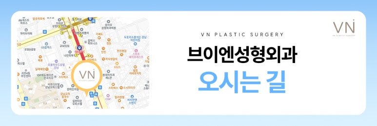 쌍꺼풀 라인, 어떤 차이점이 있을까?(ft. 인라인,인아웃,세미아웃,아웃) 관련 이미지 8