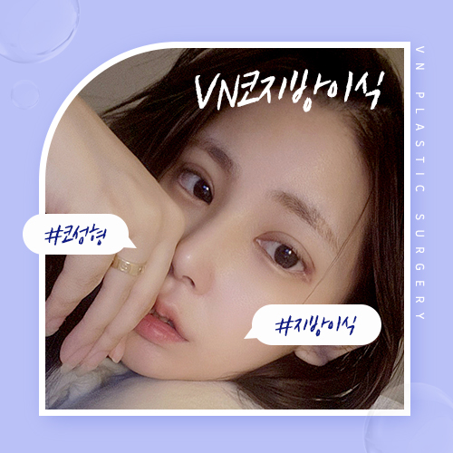 VN Plastic Surgery Coeima Fat Grafting That Determines a Refined Impression image 2