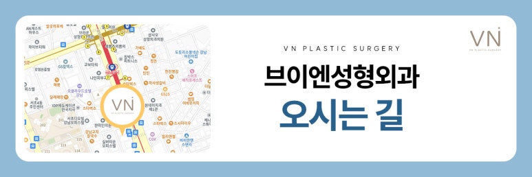 남자눈성형 자연스럽게 변화하는 것이 강점 관련 이미지 8