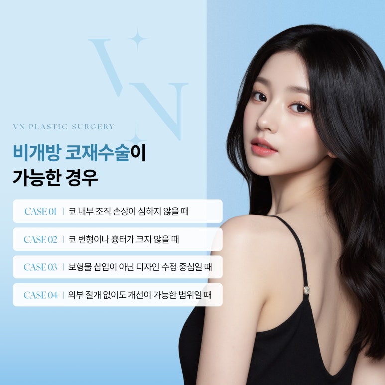 [VN Plastic Surgery] Closed Rhinoplasty Revision: Can It Reduce Scar Concerns and Be Tried Again? image 3