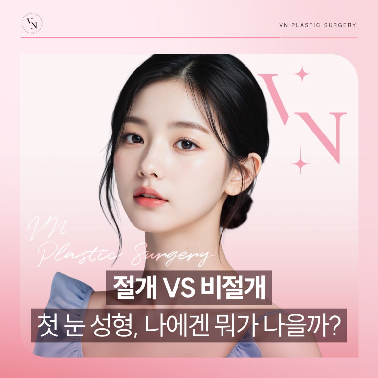첫 눈성형, 절개와 비절개 중 어떤 게 더 좋을까? 관련 이미지 1