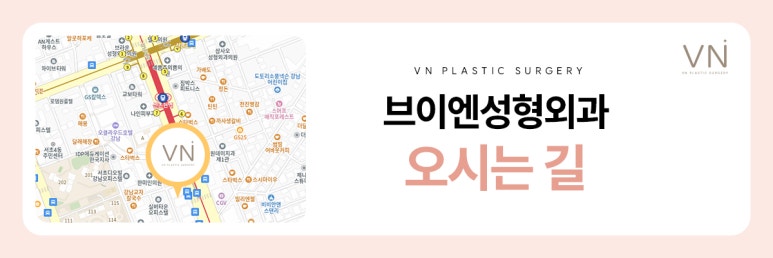 개인별 유형에 따른 코성형 수술방법 관련 이미지 8