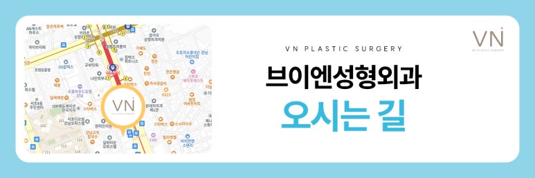 남자눈성형, 여자눈성형과는 어떤 차이점이 있나요? 관련 이미지 8
