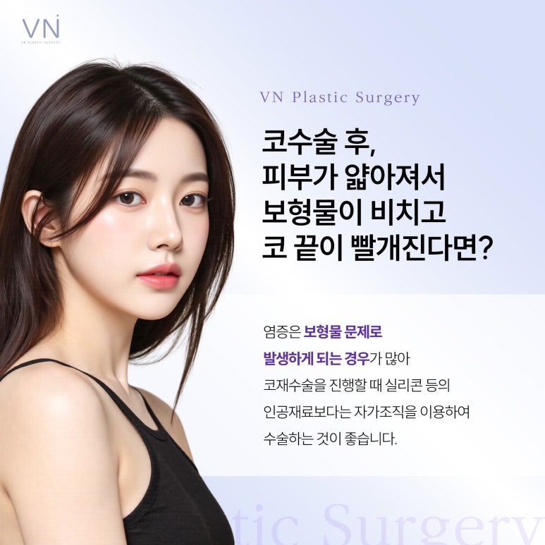 Should I Have a Nose Revision Surgery? image 5