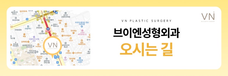 트임성형, 과하지 않고 자연스럽게 개선하는것이 포인트 관련 이미지 8