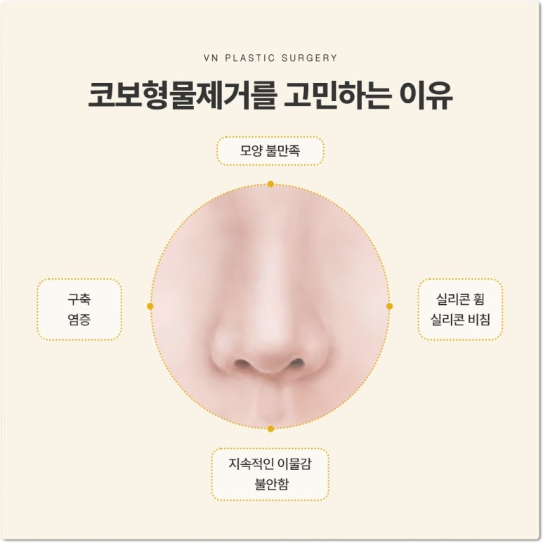 브이엔성형외과 코보형물제거 비용과 수술 후 코 모양 변화 관련 이미지 3