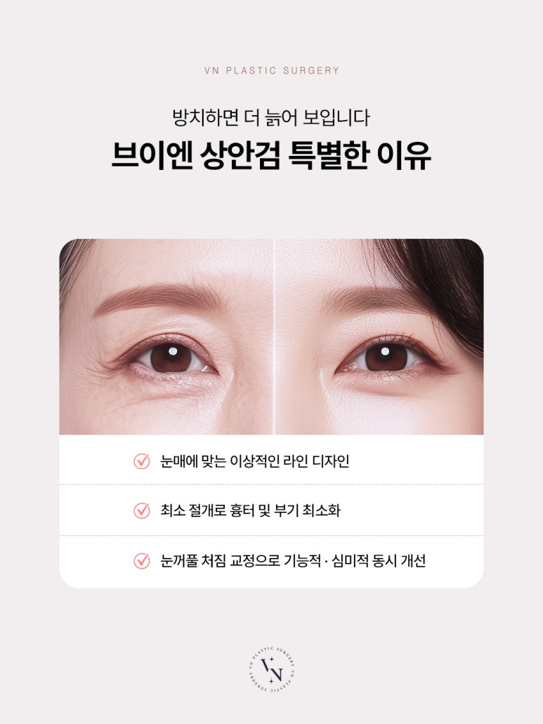 How to Effectively Address Drooping Eyelids with Upper Blepharoplasty, VN Plastic Surgery image 2