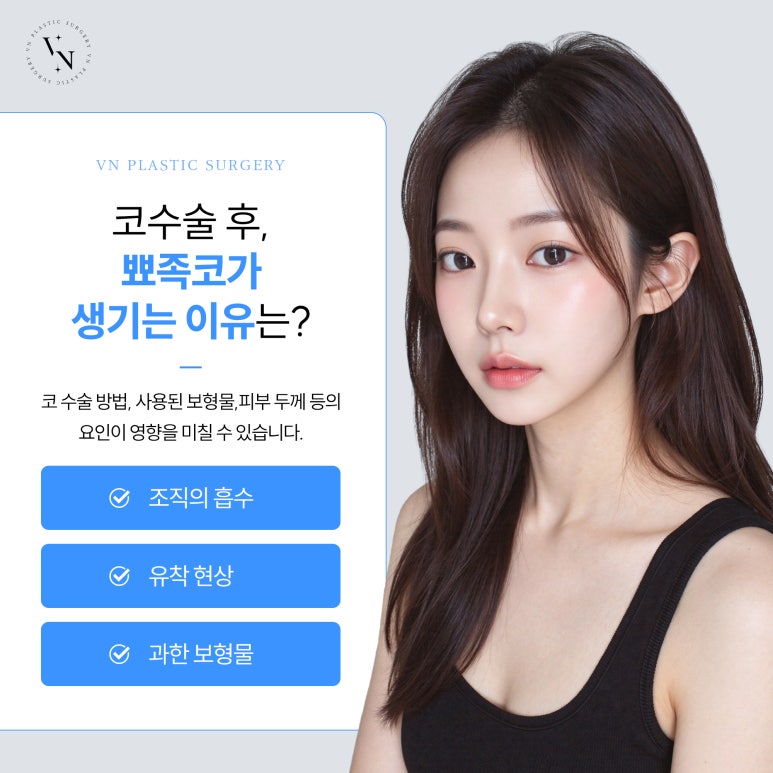 뾰족코 개선을 위한 코재수술 관련 이미지 3