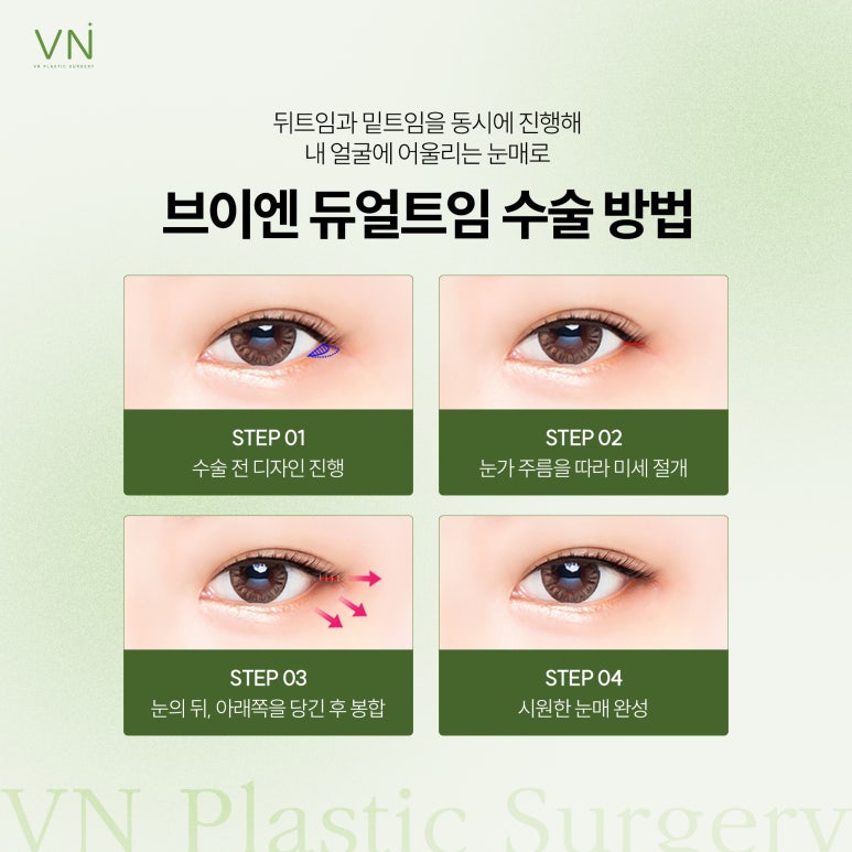 Let’s Learn About the Effects of Lower Outer Canthoplasty and When It Is Needed! image 4