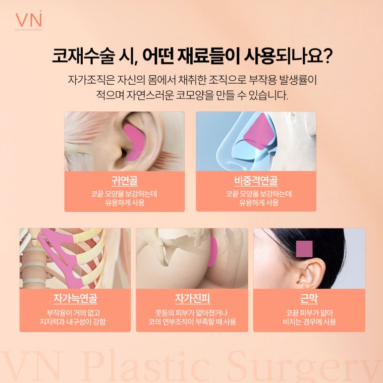 코재수술 시 어떤 재료로 수술해야 할까요? (ft. 미니자가늑코재수술) 관련 이미지 3