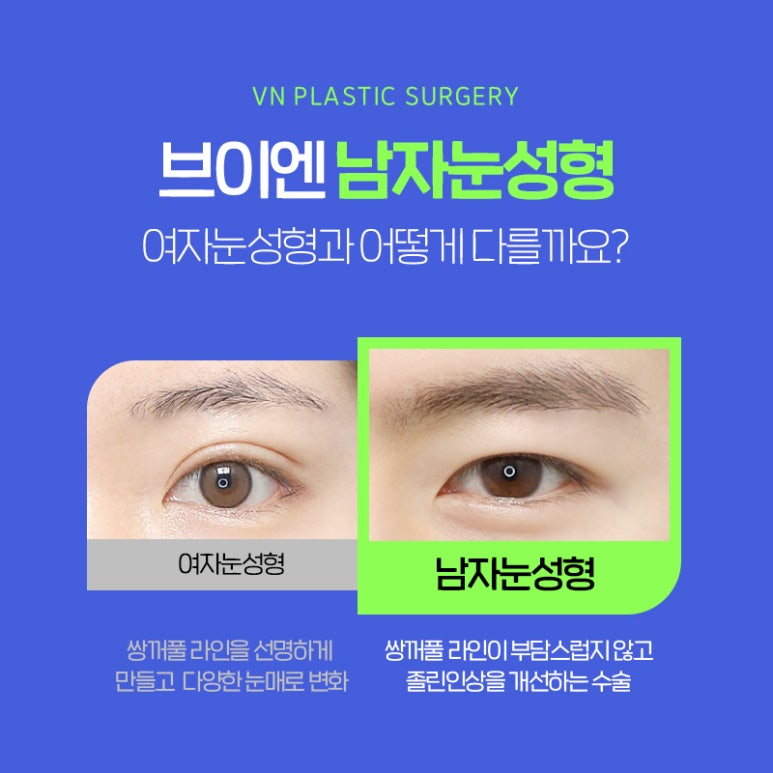 부담스럽지 않게 잘생겨지는 방법은? 브이엔성형외과 남자속쌍꺼풀성형 알아보기! 관련 이미지 2