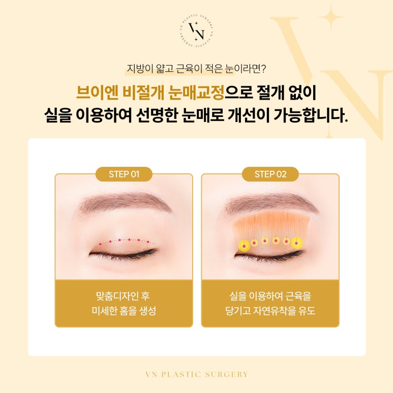 졸려 보이는 눈, 어떻게 해야 하나요? 관련 이미지 4
