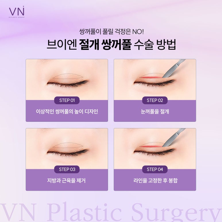 Incisional or Non-Incisional? Which Suture Method Is Suitable for Double Eyelid Surgery? image 3