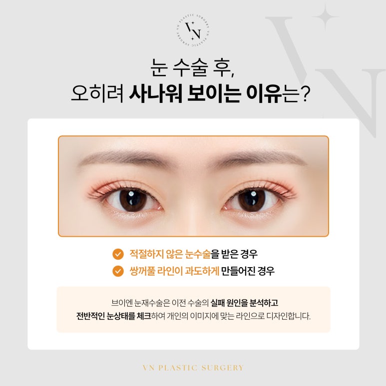 VN Plastic Surgery: If You’re Worried That Your Expression Looks Harsh After Eye Surgery image 2