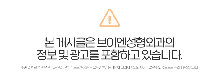 If You Are Taking Aspirin Before Surgery? [VN Plastic Surgery] image 10
