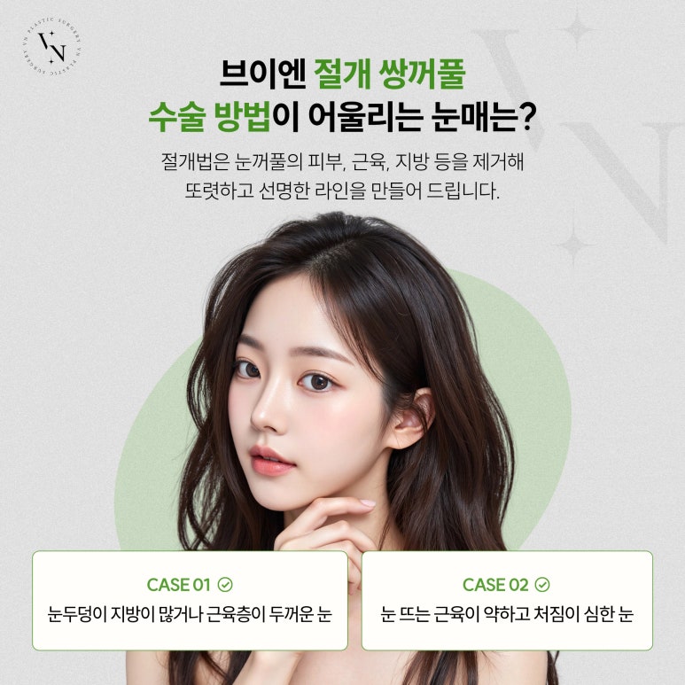 브이엔성형외과, 쌍꺼풀 수술, 부작용을 예방하고 싶다면? 관련 이미지 4