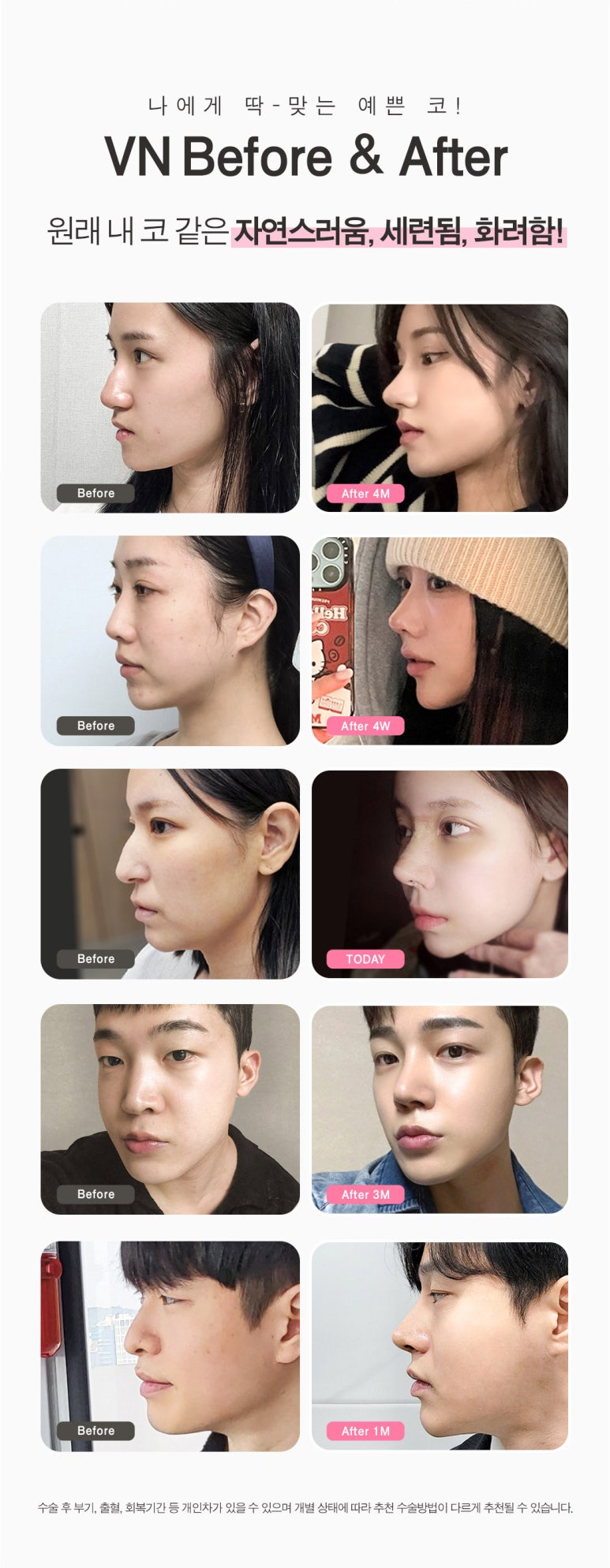College Entrance Exam Nose Surgery Event with VN Plastic Surgery ๐๐ชฝ image 6
