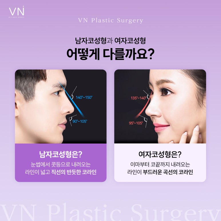 남자코성형, 여자코성형과는 어떤 게 다를까? 관련 이미지 3