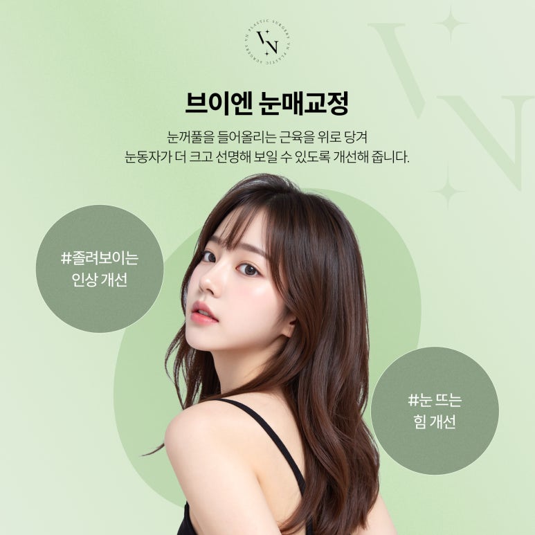 브이엔성형외과, 쌍꺼풀 수술과 눈매교정 차이점은? 관련 이미지 3