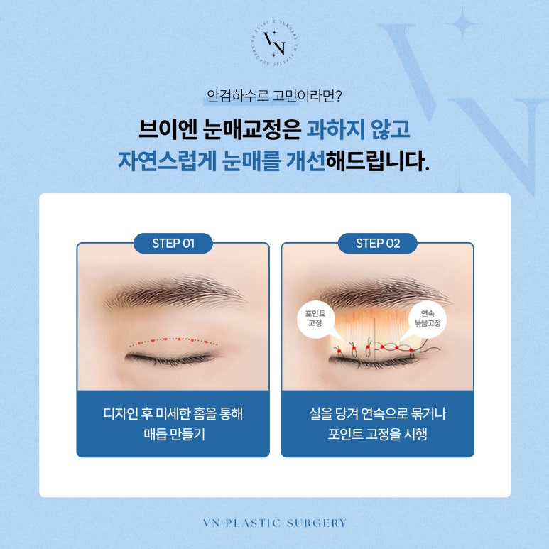 Vn Plastic Surgery: Male Eye Surgery to Correct Ptosis image 4