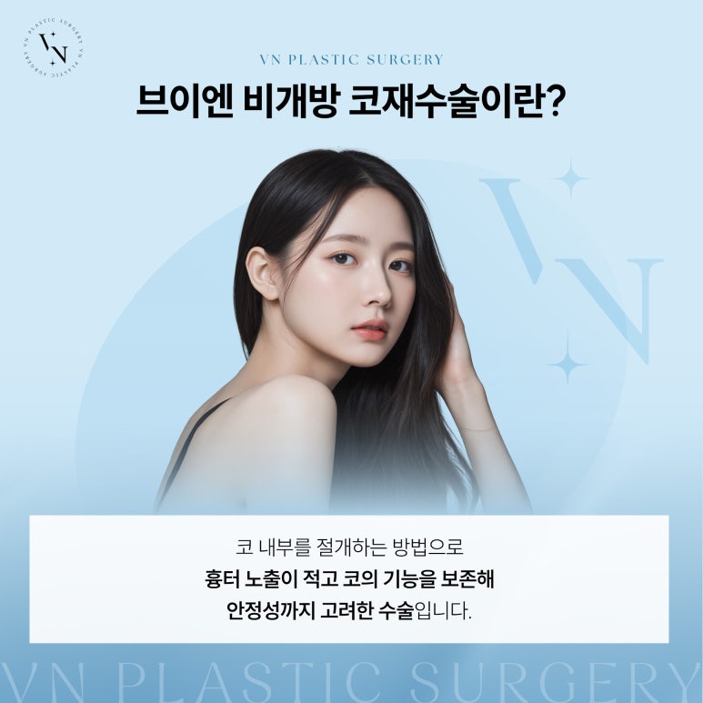 [VN Plastic Surgery] Closed Rhinoplasty Revision: Can It Reduce Scar Concerns and Be Tried Again? image 4