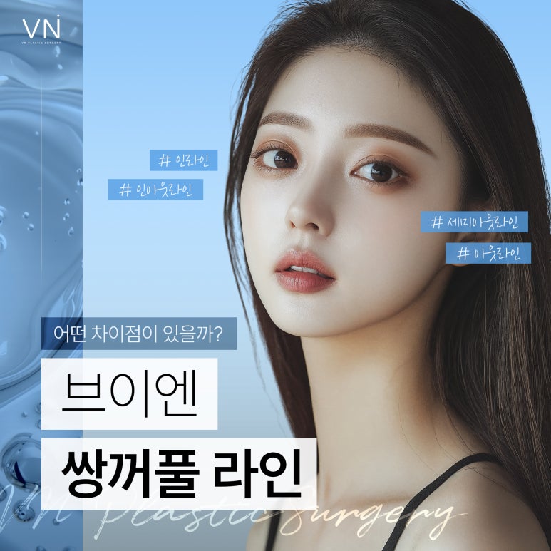 쌍꺼풀 라인, 어떤 차이점이 있을까?(ft. 인라인,인아웃,세미아웃,아웃) 관련 이미지 1