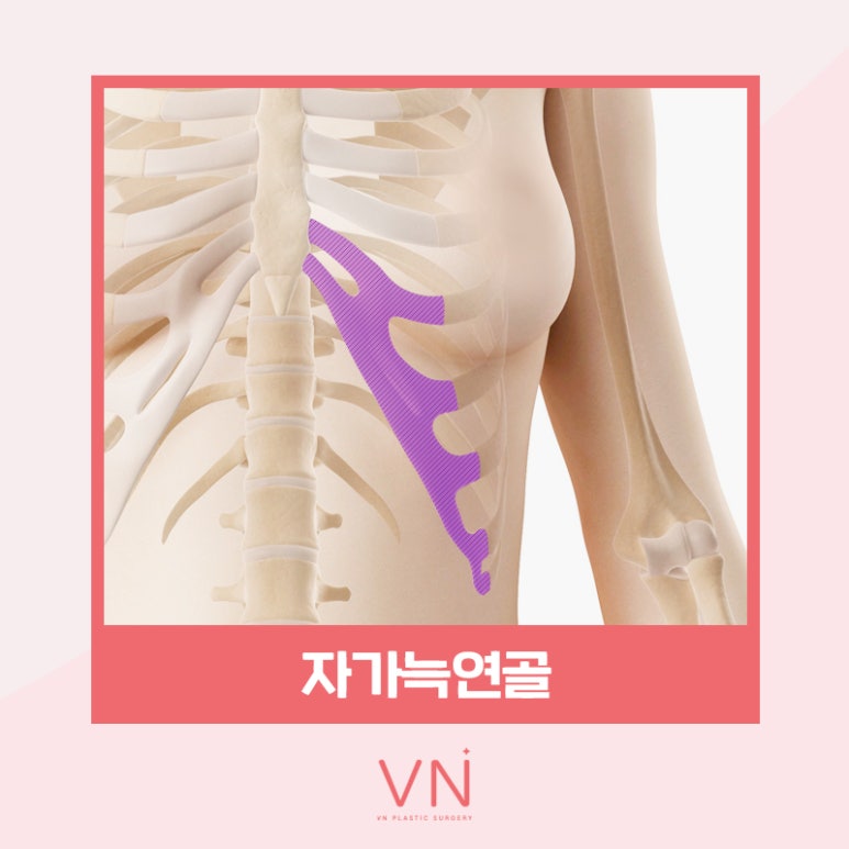 코성형수술 전이라면 클릭🖱 (feat. 수술재료 모아보기) 관련 이미지 2