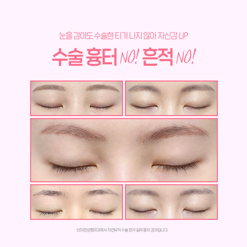 나에게 어울리는 쌍꺼풀라인 찾는 법! 쌍수 전이라면 클릭👇👇 관련 이미지 5